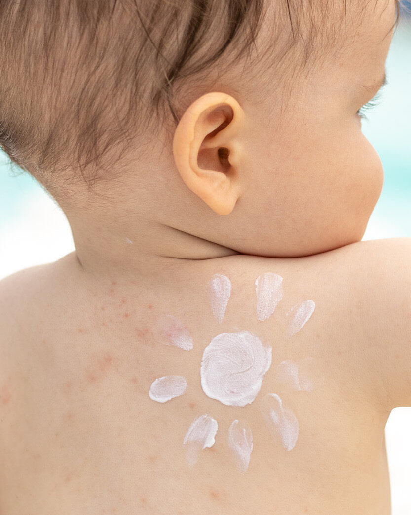 Baby with sunscreen applied on the back.